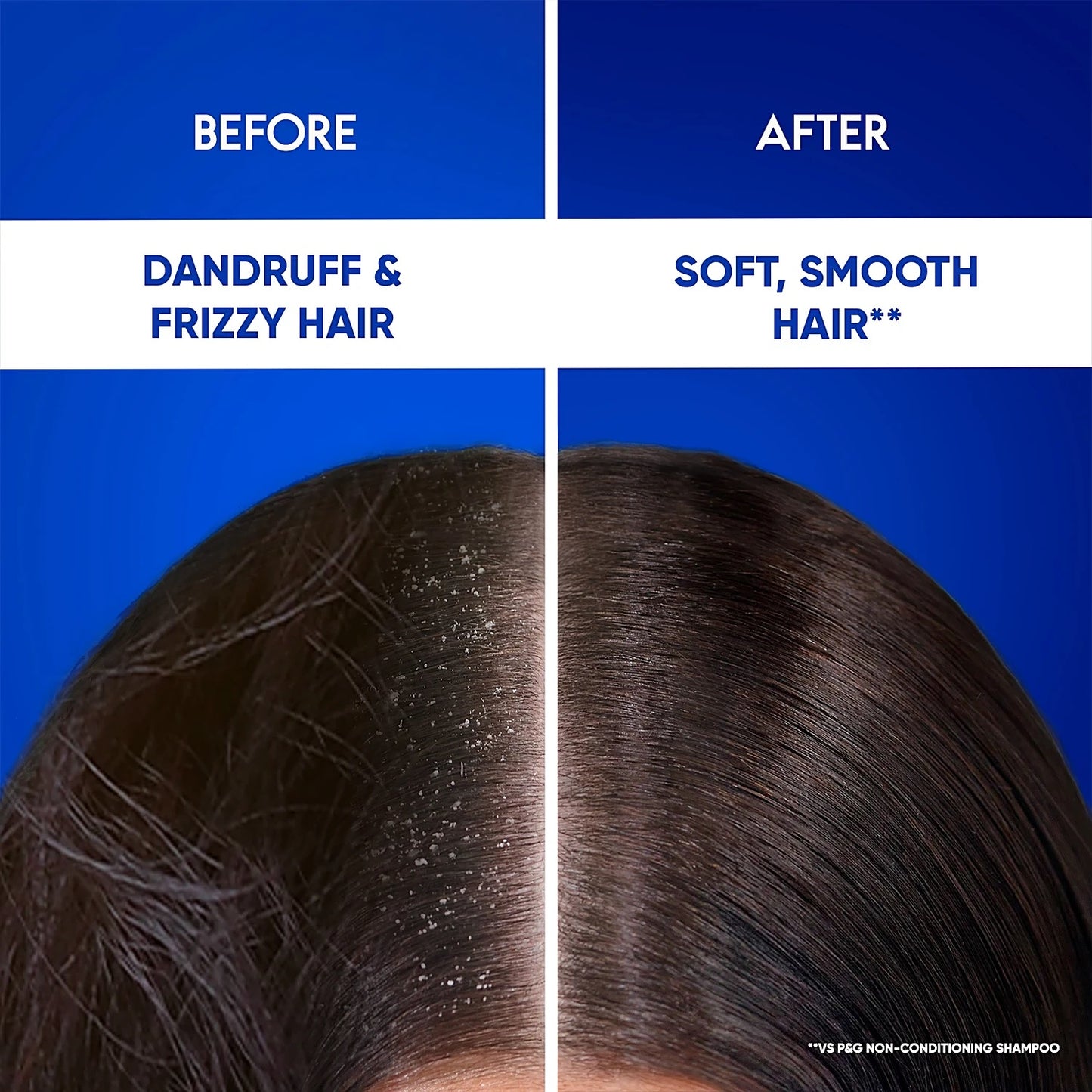 Head & Shoulders Smooth & Silky 2 in 1 Anti-Dandruff Shampoo + Conditioner, Upto 100% Dandruff Free, 1 L