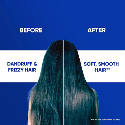 Head & Shoulders Smooth & Silky 2 in 1 Anti-Dandruff Shampoo + Conditioner, Upto 100% Dandruff Free, 1 L